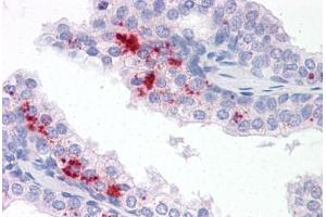 Anti-TM9SF1 antibody  ABIN960827 IHC staining of human prostate. (TM9SF1 Antikörper  (N-Term))