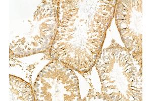ABIN6260492 and ABIN6268884 at 1/100 staining Rat testis tissue by IHC-P. (CTNNA1 Antikörper  (C-Term))