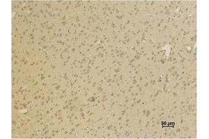 Immunohistochemistry (IHC) analysis of paraffin-embedded Rat Brain Tissue using GluR4 Polyclonal Antibody. (GRIA4 Antikörper)