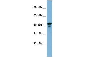 WB Suggested Anti-UEVLD Antibody Titration: 0. (UEVLD Antikörper  (N-Term))