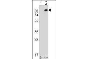 Western blot analysis of WHSC1L1 (arrow) using rabbit polyclonal WHSC1L1 Antibody (N-term) (ABIN656685 and ABIN2845923).