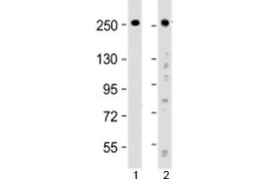 Western blot testing of human 1) HeLa and 2) SH-SY5Y cell lysate with ROBO1 antibody at 1:2000. (ROBO1 Antikörper  (AA 1097-1130))