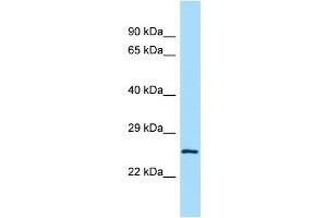 Host:  Rabbit  Target Name:  Lrrc14  Sample Type:  Mouse Testis lysates  Antibody Dilution:  1. (LRRC14 Antikörper  (C-Term))