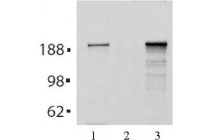 Tes2 mAb (Clone 21F11) tested by Immunoprecipitation. (TET2 Antikörper  (AA 1-300))