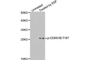 Western Blotting (WB) image for anti-Cyclin-Dependent Kinase Inhibitor 1B (p27, Kip1) (CDKN1B) (pThr187) antibody (ABIN1870060) (CDKN1B Antikörper  (pThr187))