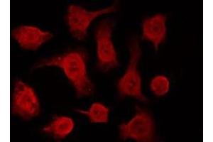 ABIN6266612 staining HeLa by IF/ICC. (p63 Antikörper  (C-Term))