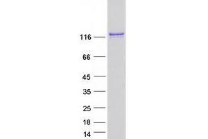 Western Blotting (WB) image for erythrocyte Membrane Protein Band 4.1-Like 1 (EPB41L1) (Transcript Variant 1) protein (Myc-DYKDDDDK Tag) (ABIN2720222)