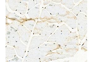 Phospho-TOP2A (Thr1343) Antibody at 1/100 staining Mouse muscle tissue by IHC-P.