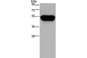 Western Blot analysis of Hela cell using CD160 Polyclonal Antibody at dilution of 1:250 (CD160 Antikörper)