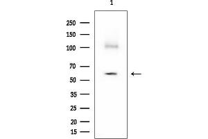 Western blot analysis of lysates from Mouse liver, using PDPK1 Mouse Monoclonal Antibody at 1/1000 dilution.