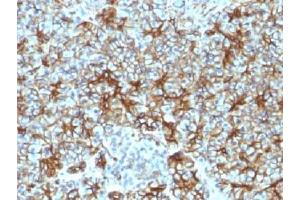 IHC testing of FFPE human pancreas with Spectrin beta III antibody (clone SPTBN2/1583). (Spectrin, Beta, Non-erythrocytic 2 (SPTBN2) (AA 356-475) Antikörper)