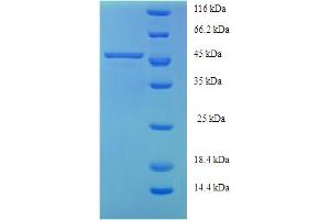 SDS-PAGE (SDS) image for Alanine Glyoxylate Aminotransferase (AGXT) (AA 1-392), (full length) protein (His tag) (ABIN5709013) (AGXT Protein (AA 1-392, full length) (His tag))