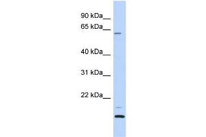 WB Suggested Anti-TCP11L2 Antibody Titration: 0. (TCP11L2 Antikörper  (N-Term))