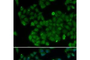 Immunofluorescence analysis of U2OS cells using DNMT3L Polyclonal Antibody (DNMT3L Antikörper)