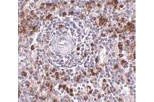 Immunohistochemistry of EBI3 in human spleen tissue with EBI3 antibody at 2. (EBI3 Antikörper  (C-Term))