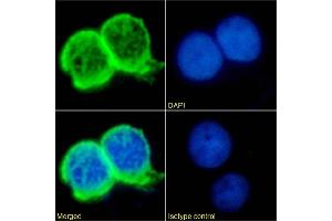 Immunofluorescence staining of Jurkat cells using anti-TAG-72 antibody Minretumomab (CC49) Immunofluorescence analysis of paraformaldehyde fixed Jurkat cells immobilized on Shi-fix™ cover-slips and stained with the chimeric rabbit IgG version of Minretumomab (CC49) (ABIN7072524) at 10 μg/mL followed by Alexa Fluor® 488 secondary antibody (2 μg/mL), showing strong membrane staining. (Rekombinanter TAG-72 (Minretumomab Biosimilar) Antikörper)