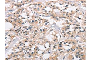 Immunohistochemistry (IHC) image for anti-Collagen, Type VII, alpha 1 (COL7A1) antibody (ABIN7190329)