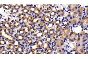 Immunohistochemistry (IHC) image for anti-Dipeptidyl-Peptidase 4 (DPP4) (AA 631-760) antibody (ABIN7438238)
