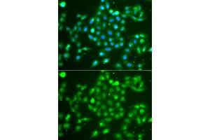 Immunofluorescence analysis of A549 cells using UCHL5 antibody. (UCHL5 Antikörper)