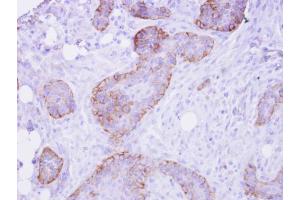 IHC-P Image FRS2 antibody detects FRS2 protein at membrane on HSC-3 xenograft by immunohistochemical analysis. (FRS2 Antikörper  (Center))