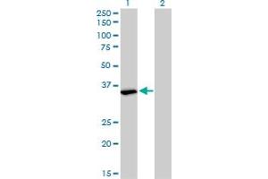 Western Blotting (WB) image for anti-Fragile X Mental Retardation 1 (FMR1) (AA 121-220) antibody (ABIN560937)