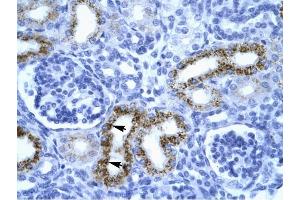 Immunohistochemistry (IHC) image for anti-serpin Peptidase Inhibitor, Clade F (Alpha-2 Antiplasmin, Pigment Epithelium Derived Factor), Member 1 (SERPINF1) (N-Term) antibody (ABIN926996)