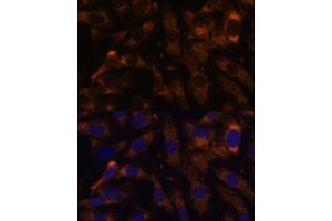 Immunofluorescence analysis of U-2 OS cells using SUCLG2 Polyclonal Antibody  at dilution of 1:100 (40x lens). (SUCLG2 Antikörper  (AA 50-300))