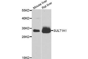 Western blot analysis of extracts of various cell lines, using SULT1A1 antibody. (SULT1A1 Antikörper  (AA 1-295))