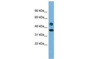 Image no. 1 for anti-SET Domain Containing 6 (SETD6) (AA 359-408) antibody (ABIN6743580) (SETD6 Antikörper  (AA 359-408))