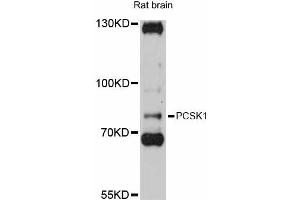 Western blot analysis of extracts of rat brain, using PCSK1 antibody (ABIN5998474) at 1:3000 dilution. (PCSK1 Antikörper)