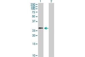 Western Blot analysis of WBP2NL expression in transfected 293T cell line by WBP2NL MaxPab polyclonal antibody. (WBP2NL Antikörper  (AA 1-309))