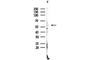 Western blot analysis of lysates from F10-LUC cells(UV,30 min treatment), using CELF-1 Antibody at 1/1000 dilution.