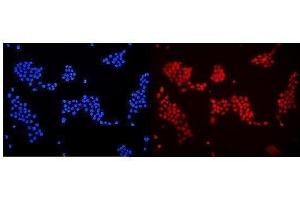 IF analysis of DDB1 using anti-DDB1 antibody (ABIN3043823). (DDB1 Antikörper  (AA 1011-1140))