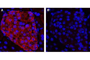 Expression of KCNK16  in mouse pancreas.