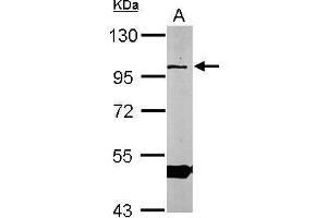 Western Blotting (WB) image for anti-Oxysterol Binding Protein-Like 1A (OSBPL1A) (C-Term) antibody (ABIN2856530)