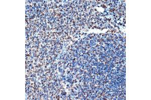 Immunohistochemistry (IHC) image for anti-Tumor Necrosis Factor Receptor Superfamily, Member 10d, Decoy with Truncated Death Domain (TNFRSF10D) antibody (ABIN7271063)