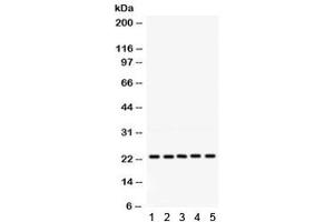 Western blot testing of 1) rat testis, 2) rat lung, 3) human 293, 4) human HeLa and 5) human HepG2 lysate with RAB18 antibody. (RAB18 Antikörper)