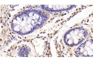 Detection of FAS in Porcine Colon Tissue using Polyclonal Antibody to Factor Related Apoptosis (FAS) (FAS Antikörper)
