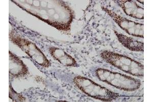 Image no. 1 for anti-WD Repeat Domain 4 (WDR4) (AA 1-267) antibody (ABIN599154) (WDR4 Antikörper  (AA 1-267))