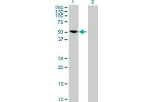 Western Blot analysis of MNDA expression in transfected 293T cell line by MNDA MaxPab polyclonal antibody. (MNDA Antikörper  (AA 1-407))