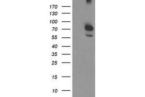 Western Blotting (WB) image for anti-Calpain 9 (CAPN9) antibody (ABIN1497091)