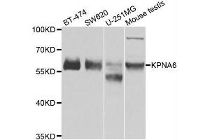 Western blot analysis of extracts of various cell lines, using KPNA6 antibody. (KPNA6 Antikörper  (AA 277-536))