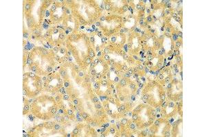 Immunohistochemistry of paraffin-embedded Mouse kidney using MOCS3 Polyclonal Antibody at dilution of 1:100 (40x lens). (MOCS3 Antikörper)