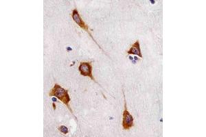 (ABIN6243853 and ABIN6577112) staining FA in human brain sections by Immunohistochemistry (IHC-P - paraformaldehyde-fixed, paraffin-embedded sections). (FAM120A Antikörper)