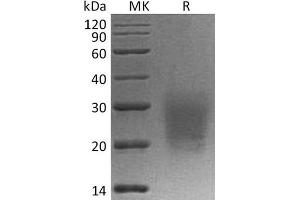 CD3D Protein (His tag)