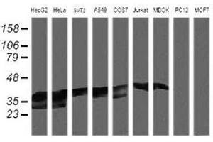 Image no. 2 for anti-Mitogen-Activated Protein Kinase Kinase 3 (MAP2K3) antibody (ABIN1499412) (MAP2K3 Antikörper)
