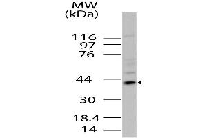 Image no. 1 for anti-Radical S-Adenosyl Methionine Domain Containing 2 (RSAD2) (AA 100-330) antibody (ABIN5027637) (RSAD2 Antikörper  (AA 100-330))