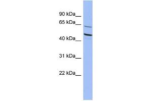 WB Suggested Anti-ZNF215 Antibody Titration:  0. (ZNF215 Antikörper  (N-Term))