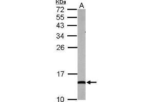 Western Blotting (WB) image for anti-NADH Dehydrogenase (Ubiquinone) 1 alpha Subcomplex, 5, 13kDa (NDUFA5) (full length) antibody (ABIN2856783)