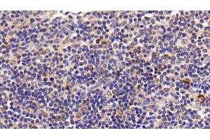 Immunohistochemistry (IHC) image for anti-Caspase 8 (CASP8) (AA 7-201) antibody (ABIN7444115)